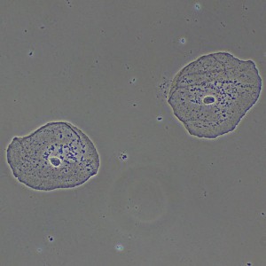 MAGUS PH2 fáziskontraszt eszköz