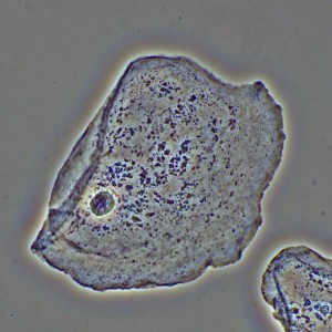 MAGUS PH2 fáziskontraszt eszköz